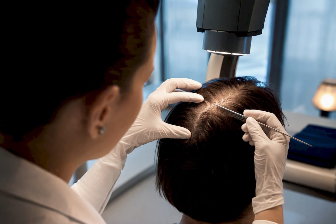 Phototrichogram assessment of scalp hair density
