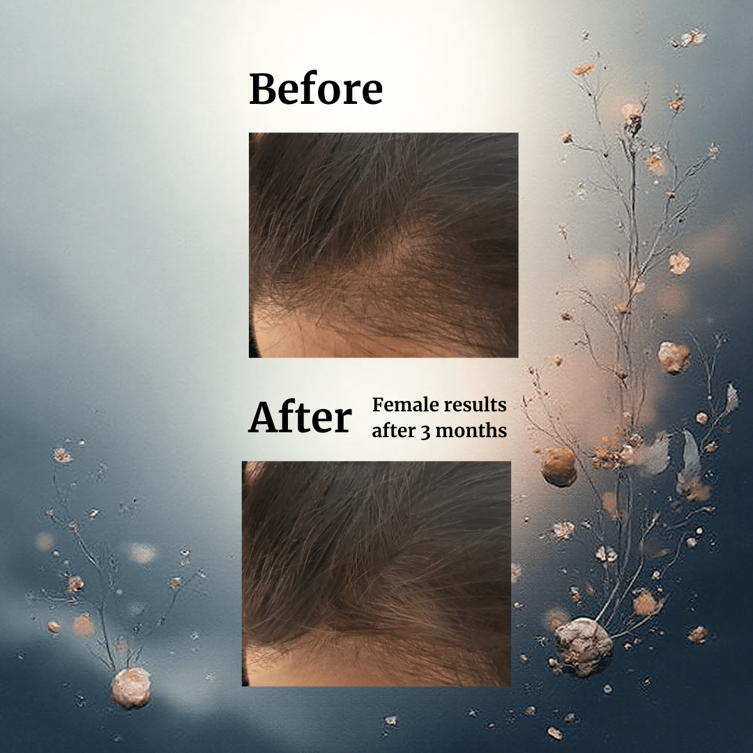 Livdor 30ml - 1 month supply LIVDOR Hair Growth Serum – 30 ml