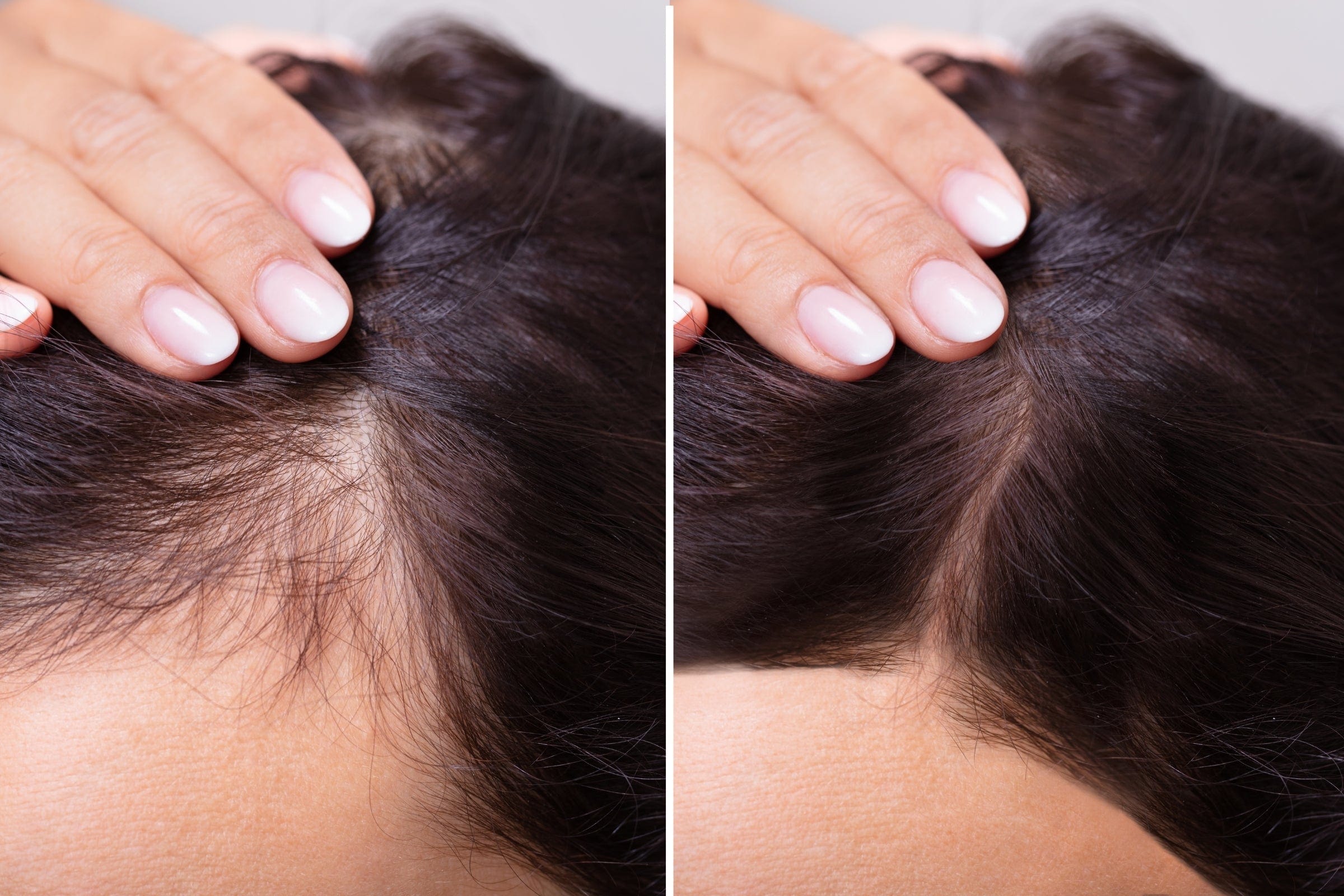 Livdor LIVDOR Pro Laser Hair Growth Cap